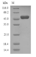 Human WT1 protein