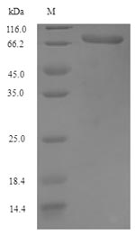 Insect Venom serine carboxypeptidase protein