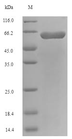 E. coli fadL protein
