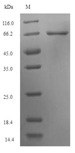 Human KRT35 protein