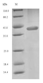 Human SLC1A6 protein