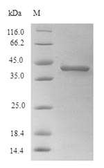 Viral GP protein