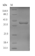 Human JAK1 protein