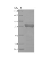 Insect Tropomyosin protein