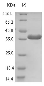 Human ZNRF3 protein