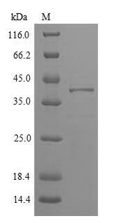 Rat Allergen Phl p Vb protein