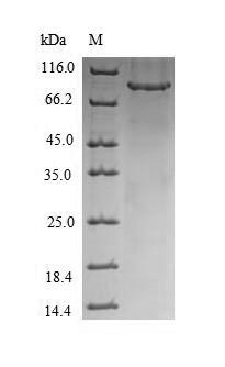 Human CHM protein
