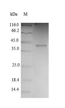 Human CDK2 protein