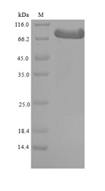 Mouse Adrbk1 protein