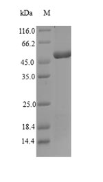 Reptile venom metalloproteinase-disintegrin-like mocarhagin protein