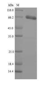 Human PNPLA2 protein