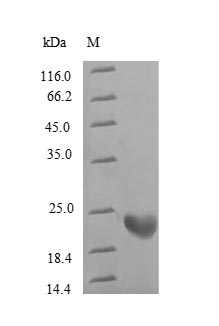 Human ARHGEF18 protein