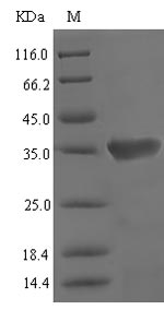 Mouse Lcn3 protein