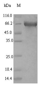 Human ACSL5 protein