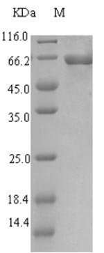 E. coli yihF protein
