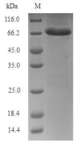 Viral Nucleoprotein protein