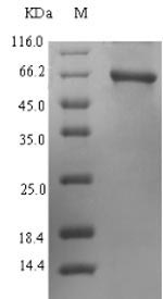 Human PPOX protein