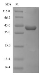 Viral GP protein