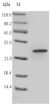 Birds Lysozyme protein