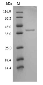 Human JAK1 protein