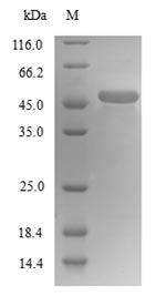 Human TUBB4A protein
