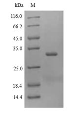 Insect Tropomyosin protein