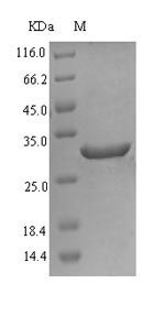 Human FADS2 protein