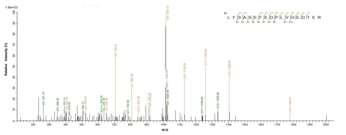 Human FDFT1 protein