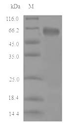 Mouse Cbs protein
