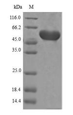 Bacterial aroA protein