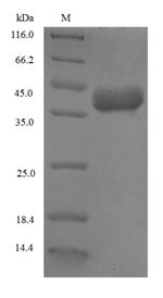 Plant Omega-5 gliadinImported protein