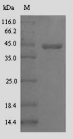 E. coli glcC protein