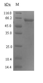 Human ADRM1 protein