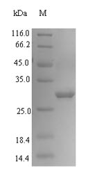 E. coli Calreticulin protein