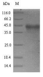 Bacterial Putative N-acetylmuramoyl-L-alanine amidase RC0497 protein