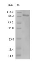 Human KLC3 protein