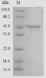 Human CHID1 protein