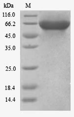 Human KLC3 protein