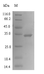 Human PHOSPHO1 protein