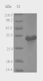 Plant MALD1 protein