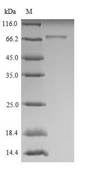 Mouse Robo1 protein