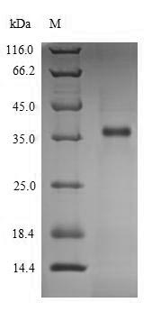 Human LDHC protein