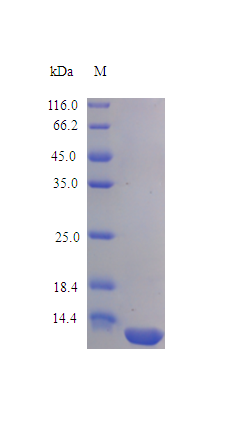 Human IL16 protein (Active)