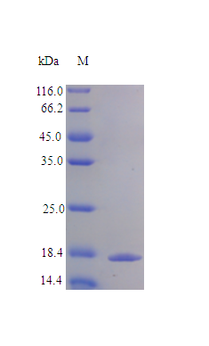 Human IL1B protein (Active)