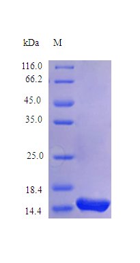 Human IL2 protein (Active)