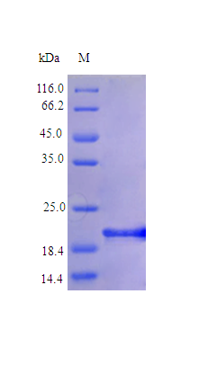 Human IL6 protein (Active)