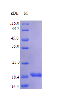 Human IL11 protein (Active)