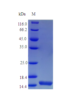 Mouse IL21 protein (Active)