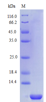 Human CCL14 protein (Active)