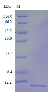 Human CCL15 protein (Active)